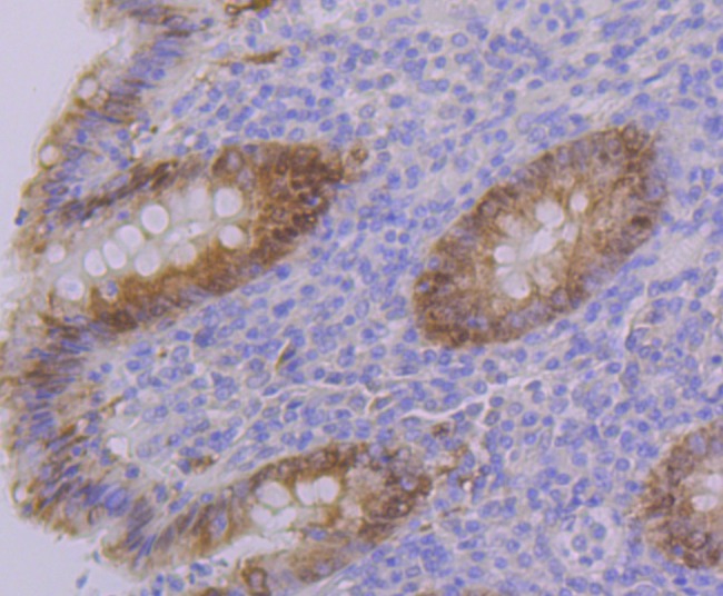 Anti-PON2 Antibody (3M227)