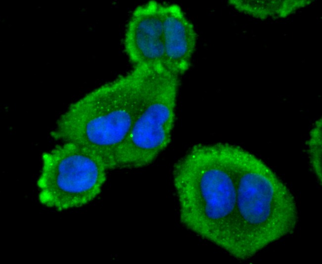 Anti-Profilin-1 Antibody (1I976)