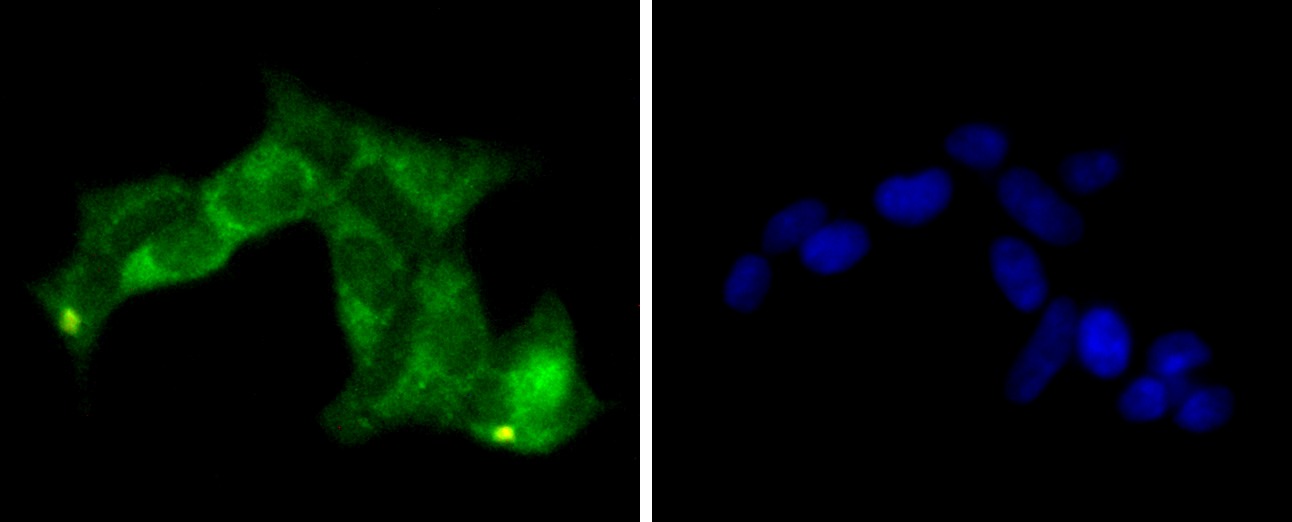Anti-PP2A alpha/beta Antibody (6N831)