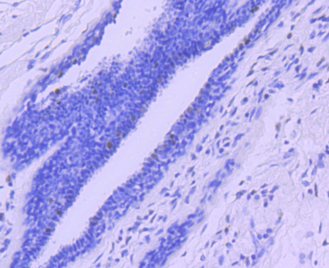 Anti-Progesterone Receptor Antibody (9Z37)