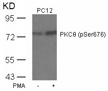 Anti-Phospho-PRKCQ (Ser676) Polyclonal Antibody