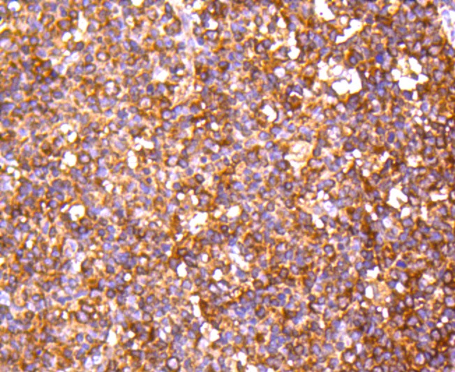 Anti-PP2A alpha/beta Antibody (6N831)