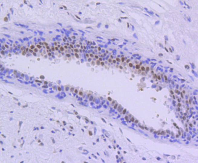 Anti-PIM1 Antibody (6F773)