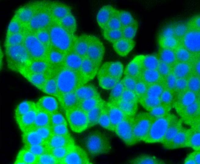 Anti-PRKCA Antibody (6S104)