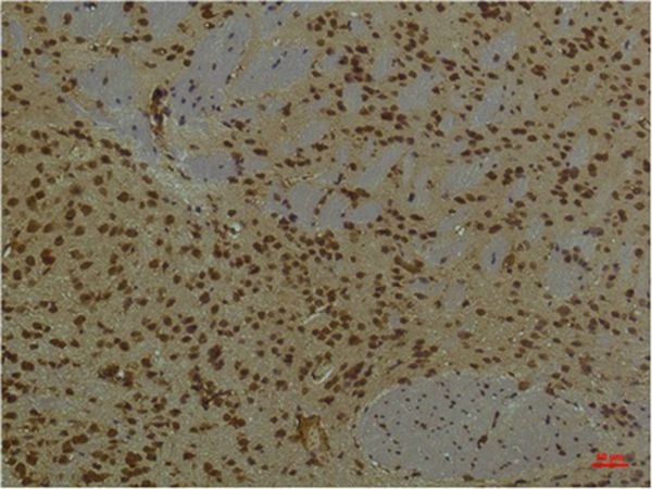 Anti-PIK3R1 Antibody (5U86)
