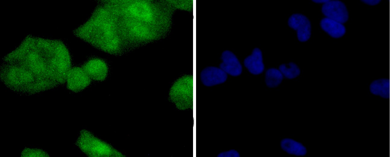 Anti-PP2A alpha/beta Antibody (6N831)
