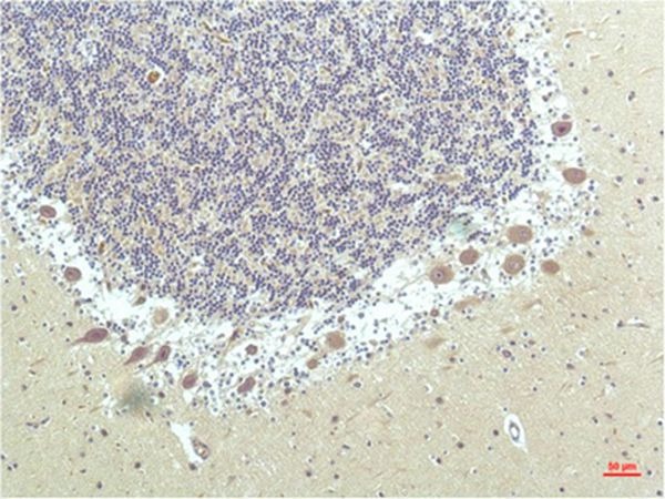 Anti-PPARD Antibody (2A714)