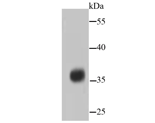 Anti-PP2A alpha/beta Antibody (6N831)