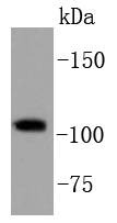 Anti-PIK3CB Antibody (1D133)