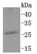 Anti-PPP1R1A Antibody (4O879)
