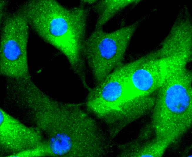 Anti-Phospho-ERK1/2 (Thr185) Antibody (1B497)