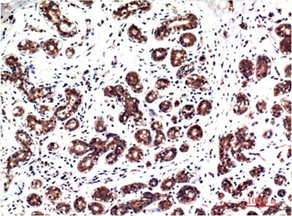 Anti-Phospho-ERK1/2 (Tyr222/205) Antibody (9X28)