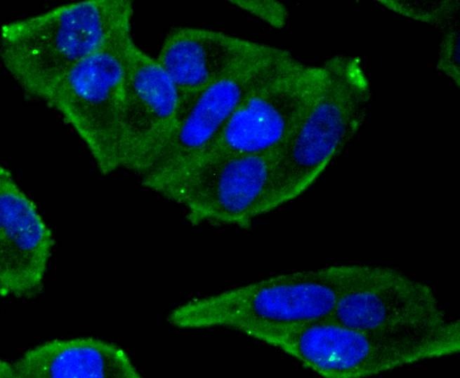 Anti-Phospho-ER alpha (Ser118) Antibody (5S971)