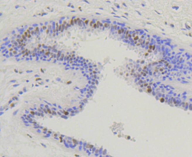 Anti-Phospho-NFE2L2 (Ser40) Antibody (7L44)