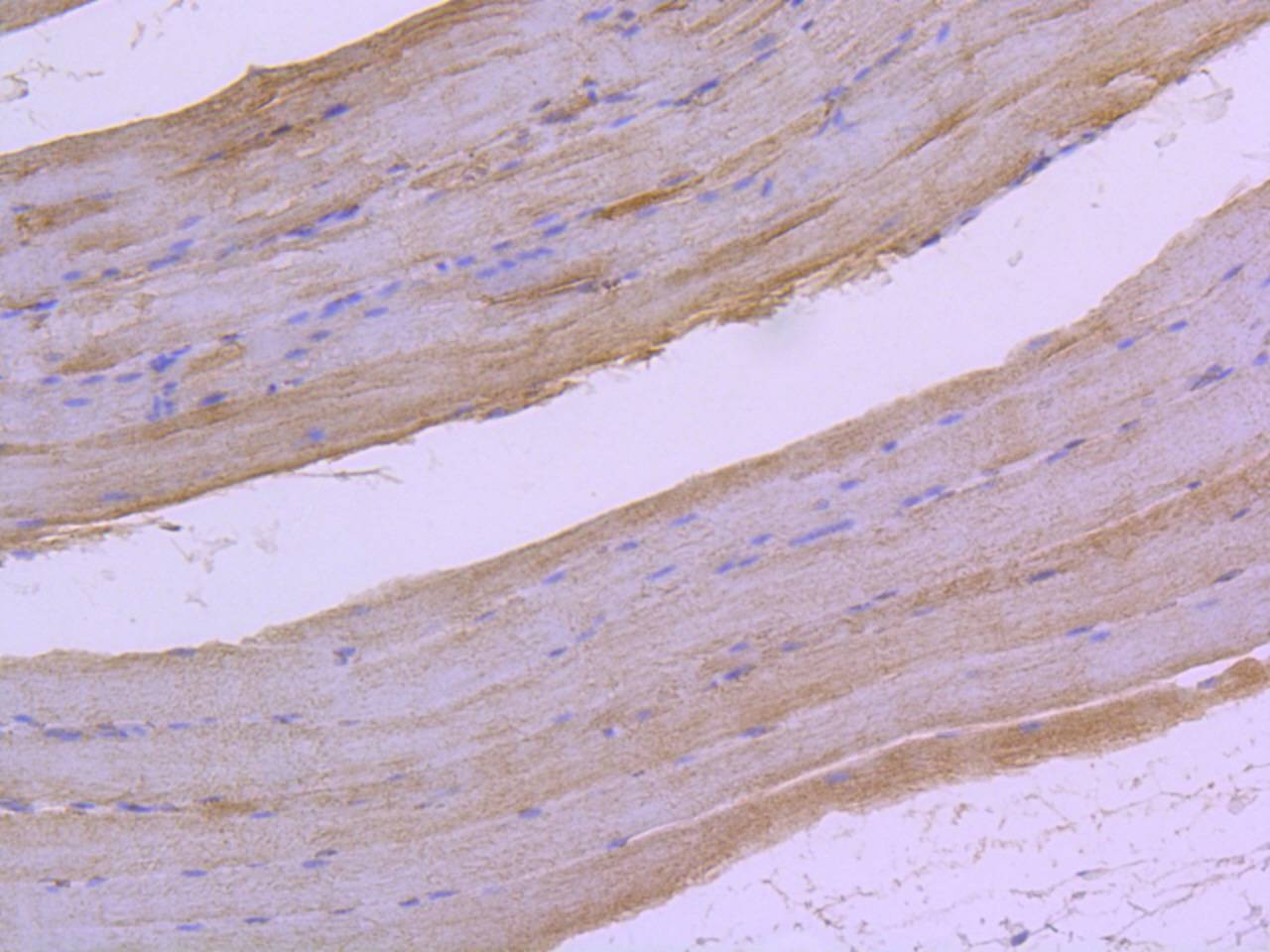 Anti-Phospho-RAF1 (Ser259) Antibody (2M259)