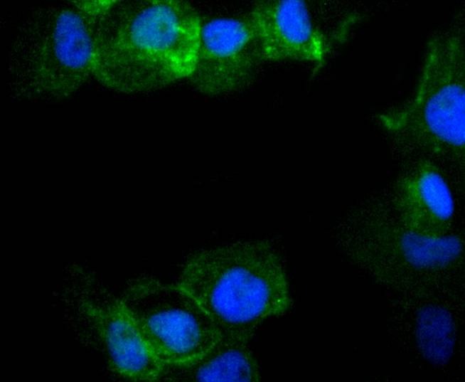 Anti-Phospho-CDC42 (Ser71) Antibody (7R21)