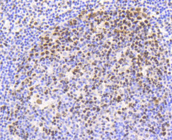 Anti-Phospho-NFE2L2 (Ser40) Antibody (7L44)