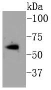 Anti-Phospho-ER alpha (Ser118) Antibody (5S971)