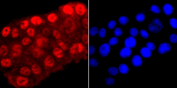 Anti-Phospho-POLR2A (Ser5) Antibody (1R812)