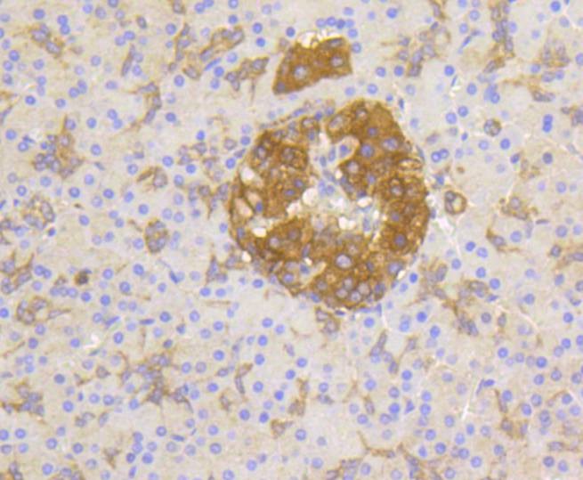 Anti-Phospho-PP2A (Tyr307) Antibody (2E533)