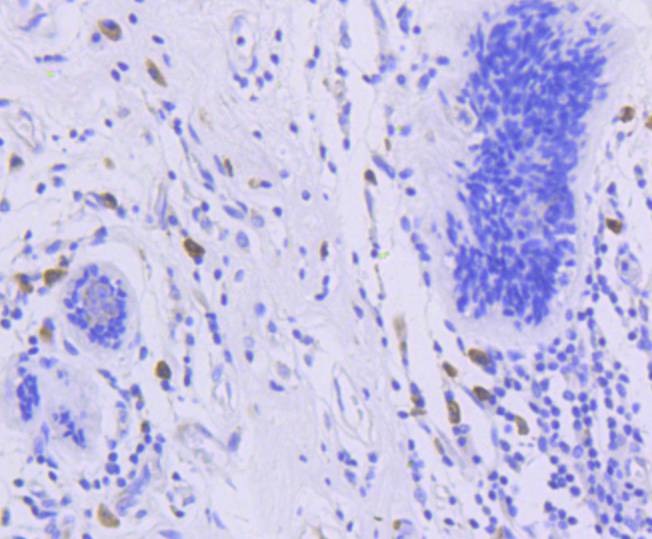 Anti-Phospho-FOXO3 (Ser253) Antibody (7U72)