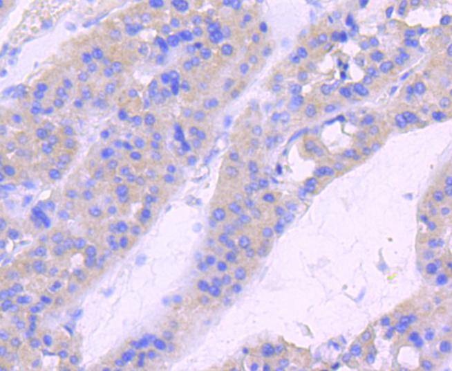 Anti-Phospho-CDC42 (Ser71) Antibody (7R21)