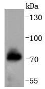 Anti-Phospho-RAF1 (Ser621) Antibody (6G681)