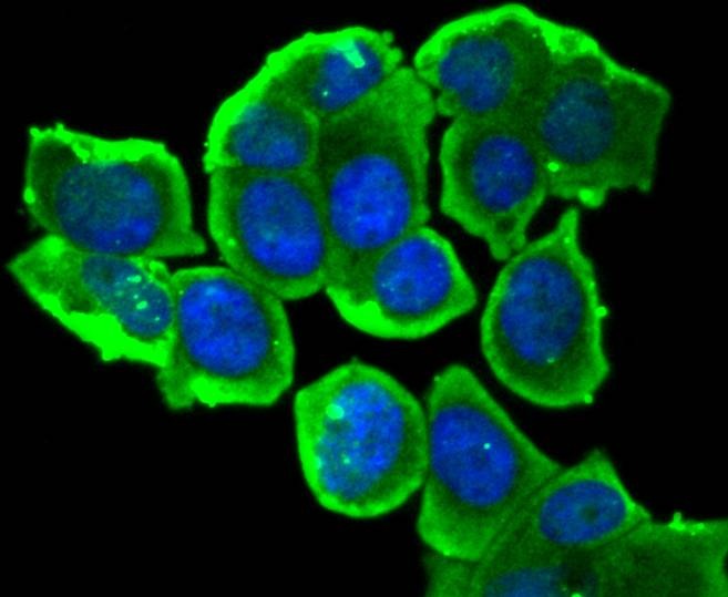 Anti-Phospho-ER alpha (Ser118) Antibody (5S971)