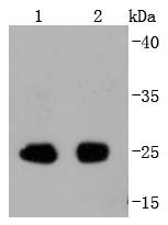 Anti-Phospho-EIF4E (Ser209) Antibody (4B622)