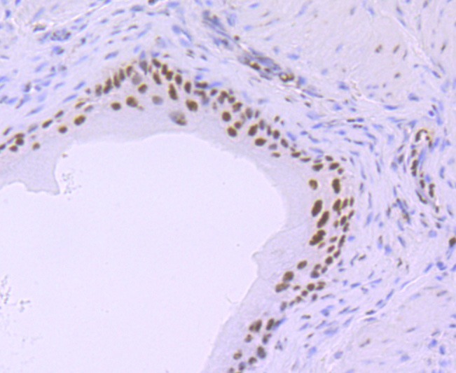 Anti-Phospho-POLR2A (Ser5) Antibody (1R812)