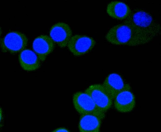 Anti-Phospho-EIF4E (Ser209) Antibody (4B622)