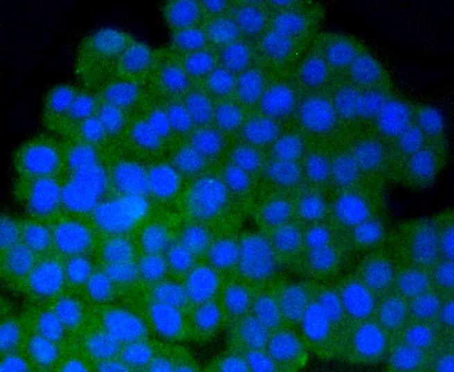 Anti-Phospho-PP2A (Tyr307) Antibody (2E533)