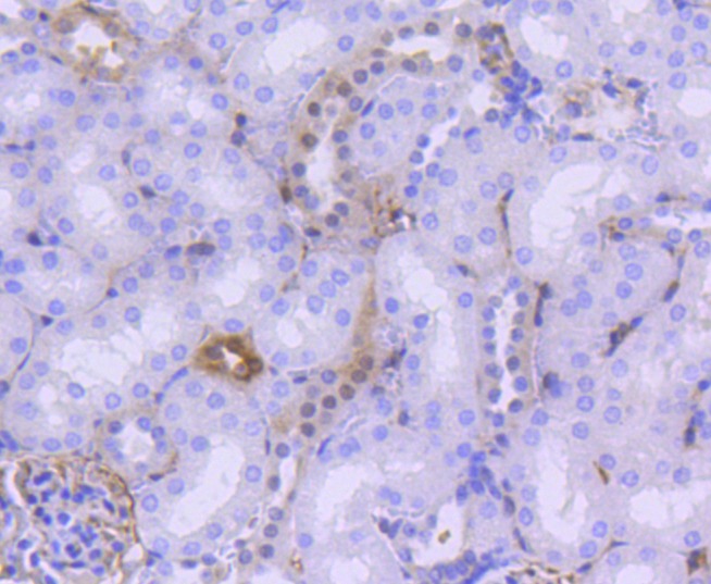 Anti-Phospho-YAP1 (Ser127) Antibody (5V148)