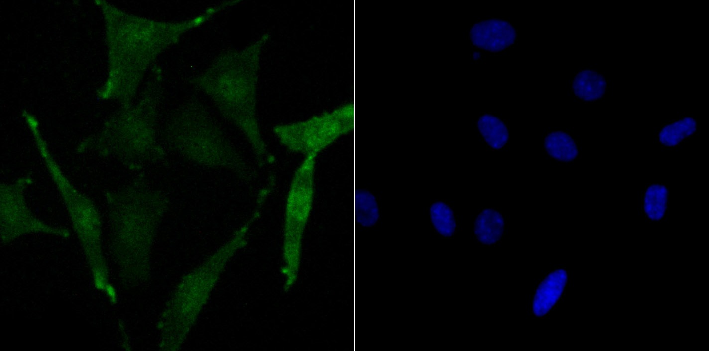 Anti-Phospho-CREB1 (Ser133) Antibody (4I795)