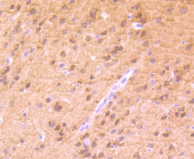 Anti-Phospho-PRKCA (Thr638) Antibody (1C677)