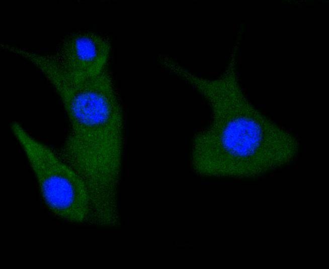 Anti-Phospho-PAK1/2/3 (Ser139) Antibody (4F435)