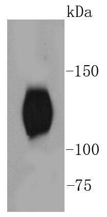 Anti-Phospho-NTRK2 (Tyr817) Antibody (6J201)