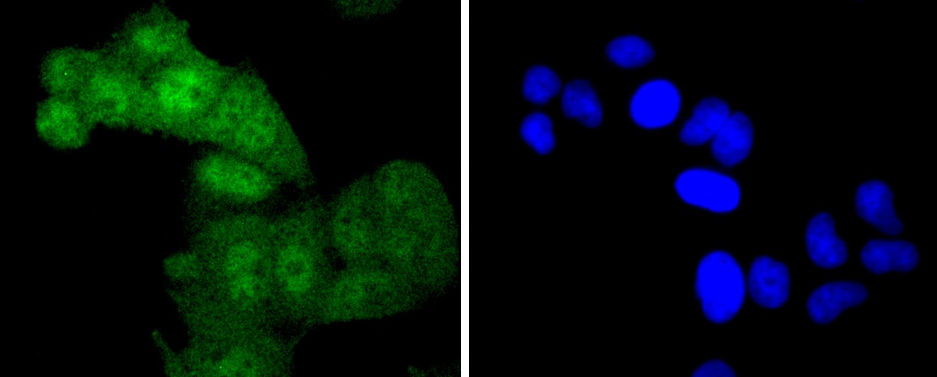 Anti-Phospho-MYC (Thr58) Antibody (7T717)