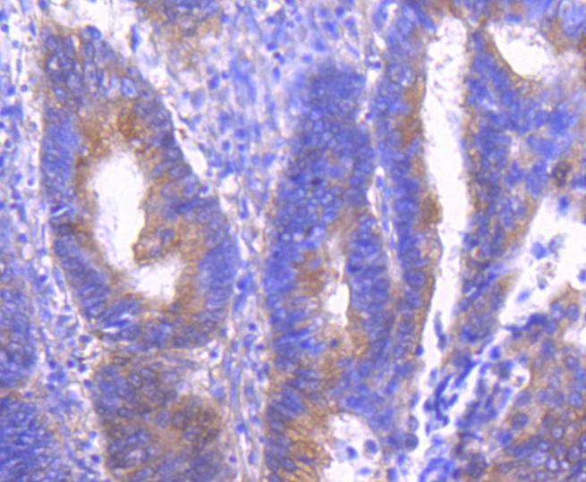 Anti-Phospho-PAK1/2/3 (Ser139) Antibody (4F435)