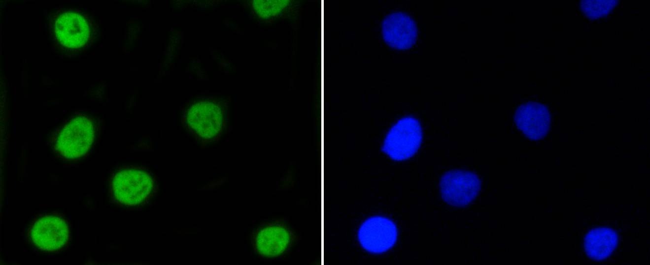 Anti-Phospho-NFE2L2 (Ser40) Antibody (7L44)