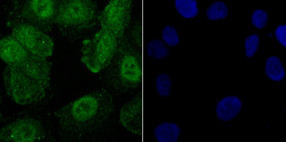 Anti-Phospho-CREB1 (Ser133) Antibody (4I795)