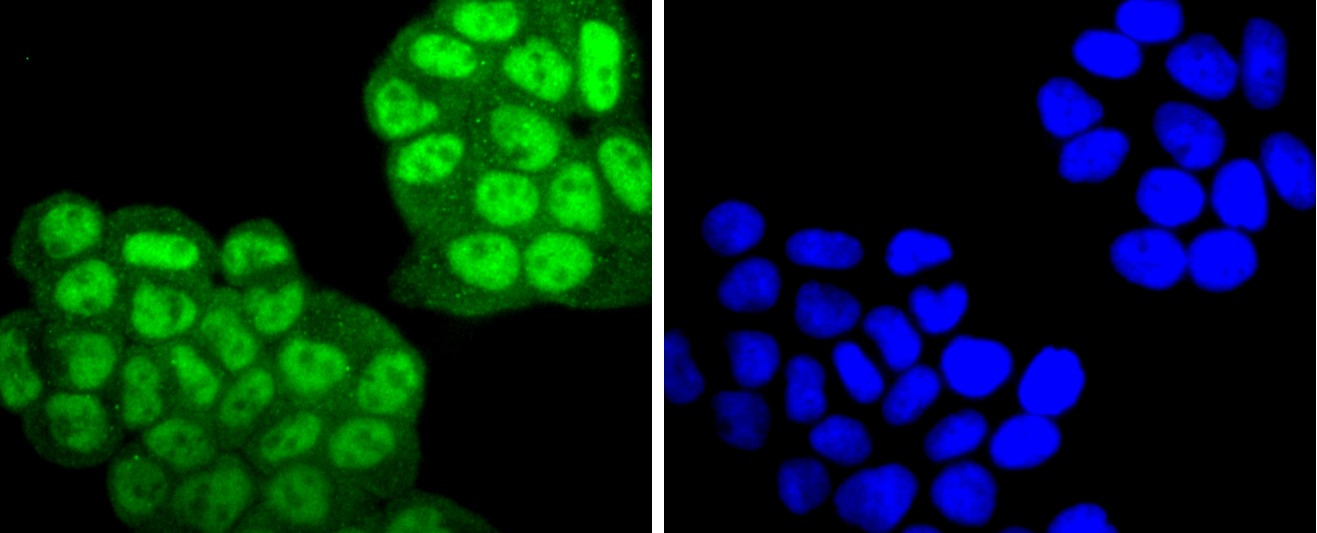 Anti-Phospho-PRKCA (Thr638) Antibody (1C677)