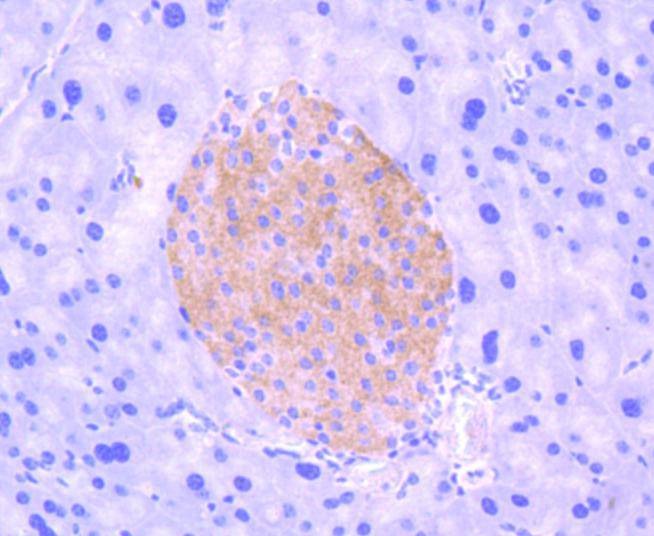 Anti-Phospho-NTRK2 (Tyr817) Antibody (6J201)