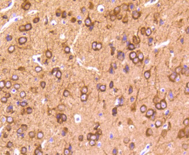 Anti-Phospho-MAPT (Thr231) Antibody (5E870)