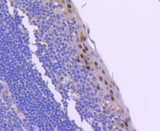 Anti-Phospho-CCNE1 (Thr77) Antibody (8N839)