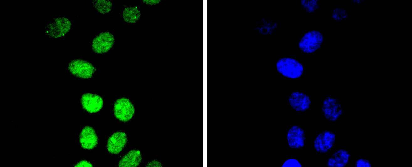 Anti-Phospho-CCNE1 (Thr77) Antibody (8N839)