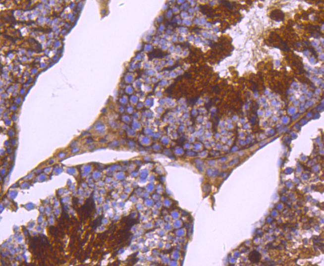 Anti-Phospho-PRKAR2A (Ser99) Antibody (9R534)