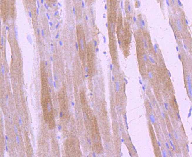 Anti-Phospho-NTRK2 (Tyr817) Antibody (6J201)