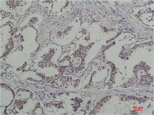 Anti-Phosphotyrosine Antibody (4V357)