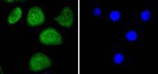 Anti-Phospho-MYC (Thr58) Antibody (7T717)